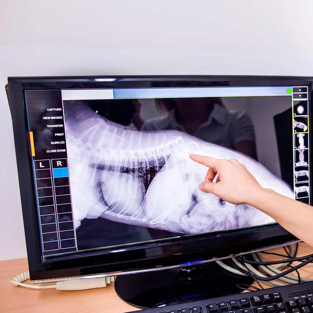 a person pointing at a  pet x-ray